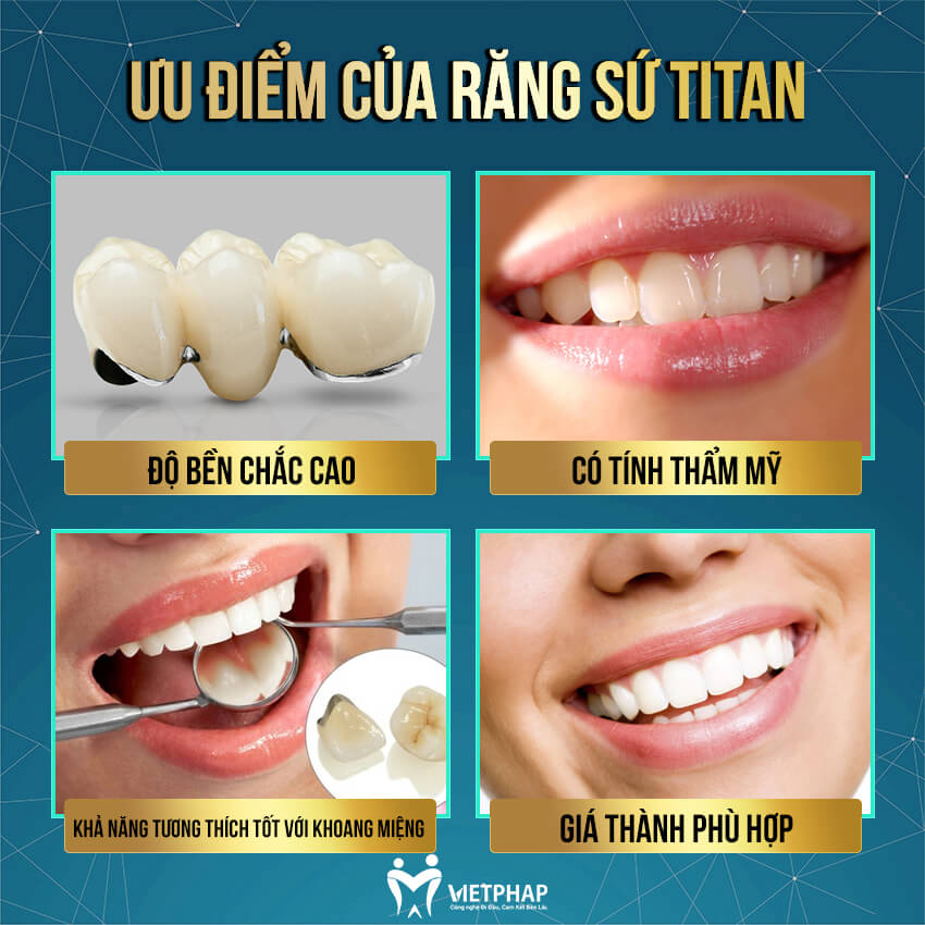 Ưu điểm của răng sứ Titan