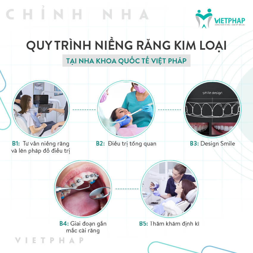 Quy trình niềng răng tại nha khoa quốc tế Việt Pháp