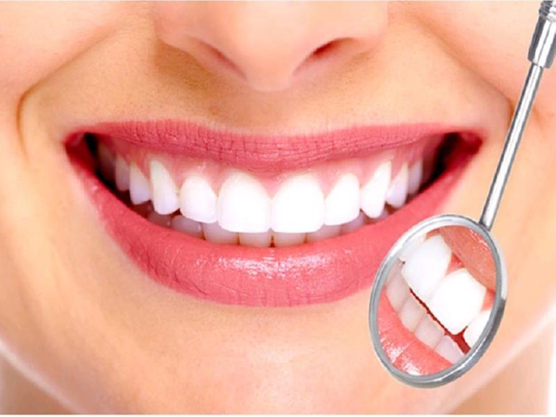 Chuyên gia tư vấn: Có nên làm răng sứ không?