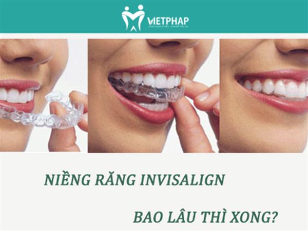 Niềng răng Invisalign bao lâu thì xong?