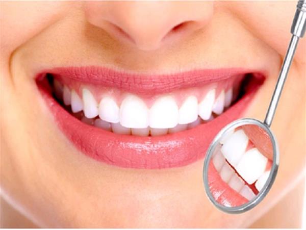 Chuyên gia tư vấn: Có nên làm răng sứ không?