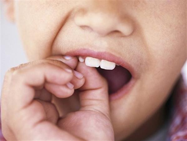 Nhổ răng sữa cho trẻ – Thế nào là “đúng thời điểm”?
