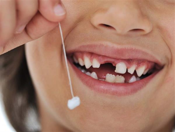 Những sai lầm thường gặp khi nhổ răng sữa cho trẻ