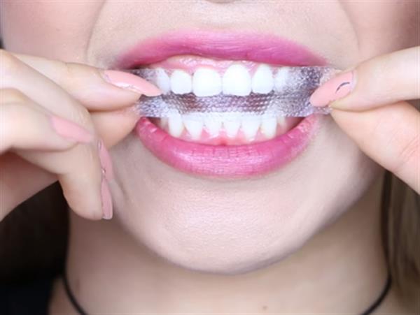 Hướng dẫn chi tiết cách sử dụng miếng dán trắng răng